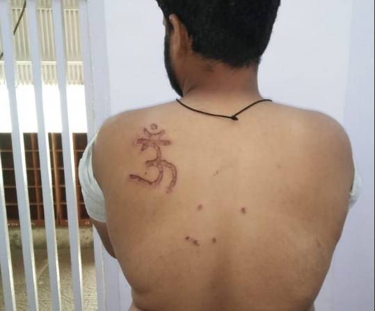 بھارت:تہاڑ جیل کےسپرنٹنڈنٹ نے مسلمان قیدی کی پیٹھ پر اوم کا نشان دغوادیا