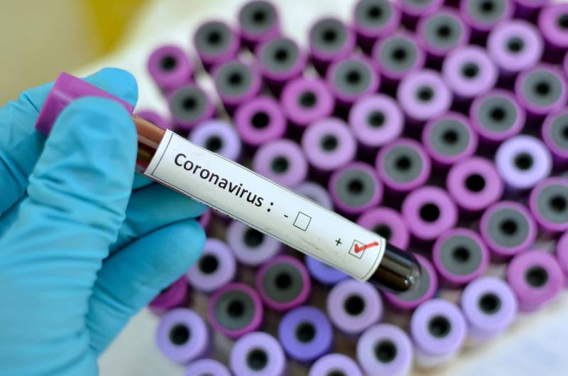نویل کرونا وائرس کی ممکنہ ویکسین آئندہ 3 ماہ میں تیار کر لی جائے گی، امریکی سائنسدان