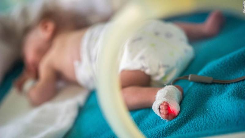 قبل از وقت پیدا ہونیوالے بچوں میں جلد موت کا خطرہ زیادہ ہوتا ہے: طبی تحقیق
