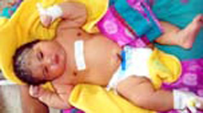 بھارت میں سب سے وزنی بچی کی پیدائش 