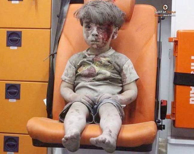 شام: فضائی حملے میں زخمی 5 سالہ عمر کی سوشل میڈیا پر تصویر نے دنیا کو ہلا کر رکھ دیا 