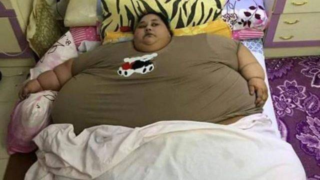 ؎ مصر :500 کلو گرام وزنی خاتون 25 برس سے گھر سے نہیں نکل سکی 