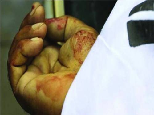 مغلپورہ انڈر پاس کے قریب سے 25 سالہ نوجوان کی تشدد زدہ نعش برآمد