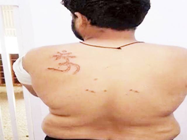 بھارتی جیل میں مسلمان قیدی کو زبردستی ہندو بنانے کی کوشش، پیٹھ پر اوم لکھ دیا